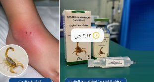 صورة توضح عبوات مضاد سم العقرب بجانب أثر لدغة عقرب على القدم، تعبيرًا عن استقبال مستشفى يفرن العام إصابات بلدغات العقارب