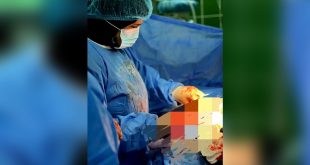 ​صورة تظهر طبيبة جراحة في غرفة عمليات مستشفى المطرد العام، مرتدية ملابس طبية زرقاء وكمامة، وهي تركز في إجراء عملية ولادة ضمن قسم النساء والولادة الجديد.